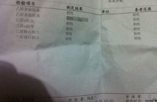 乙型肝炎表面抗体阳性是什么意思,免疫力的守护者与日常防护指南